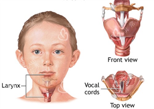 声带整形位置图解