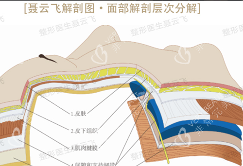 广州聂云飞面部拉皮解剖图