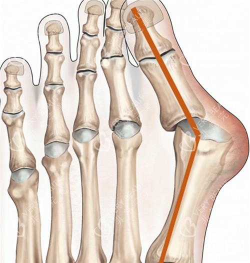 大脚骨动画图示
