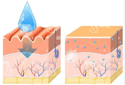 玻尿酸注射前后皮肤变化