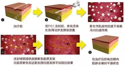 童颜针注射前后变化图解