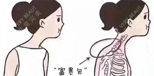 脖子富贵包卡通图展示照片