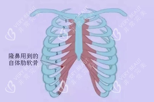 手术中一般用到的肋软骨材料