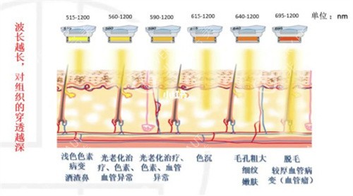 M22光子嫩肤不同波长