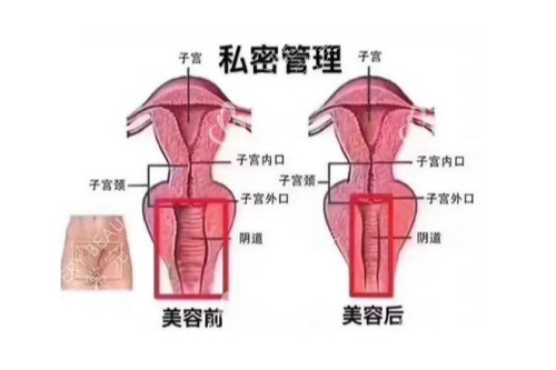 私密管理前后对比图