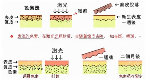 皮秒的原理素材