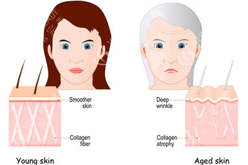 不同年龄段皮肤组织的区别图解