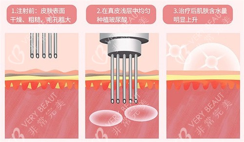 水光作用对比