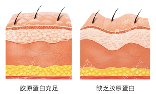 胶原蛋白