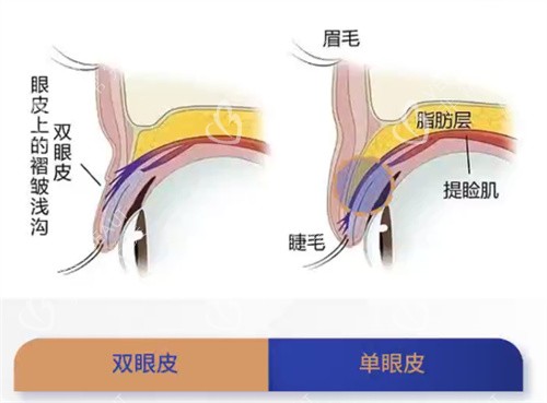 双眼皮和单眼皮结构对比