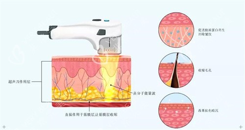 超声炮原理