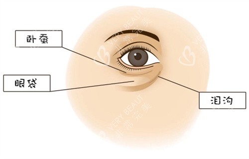 眼周问题图