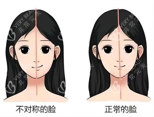 面部不对称与正常的脸对比动画图