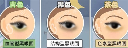 不同的黑眼圈类型