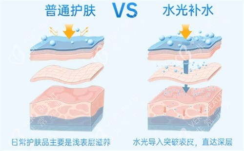 普通补水和水光补水对比