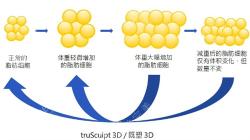 美国既塑3D溶脂原理