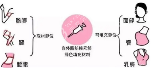 自提脂肪填充素材