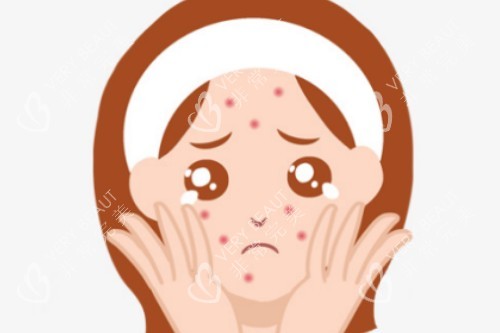 脸上长痘卡通图