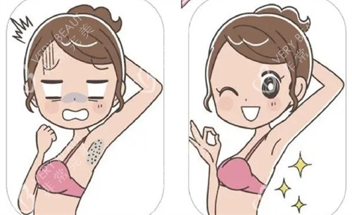 激光脱腋毛