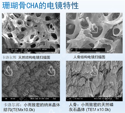 珊瑚骨特性