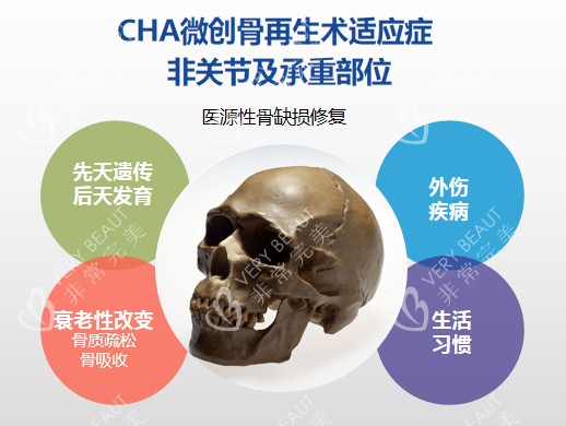 珊瑚骨适应症