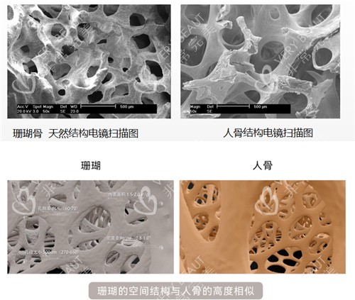 珊瑚骨结构图示