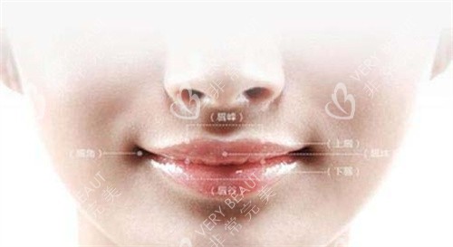 人中窝卡通图