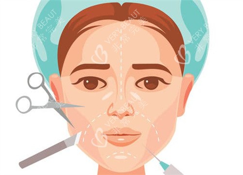 面部整形卡通图