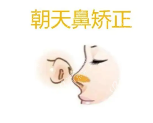 朝天鼻矫正