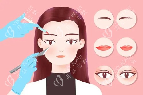 双眼皮手术卡通图