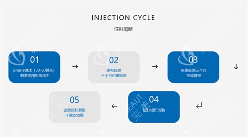 贝丽菲尔bellafill注射周期