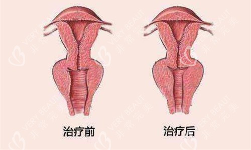 私密治疗对比图