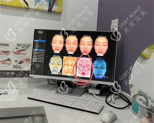 北京三仁医美的面部检前后对比