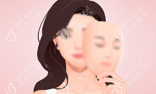 双颚手术的结果