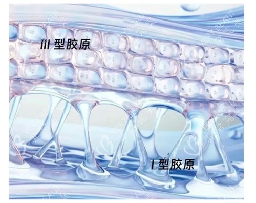 Ⅰ型胶原蛋白和Ⅲ型区别