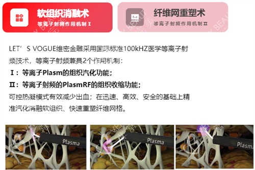 维密金雕原理介绍