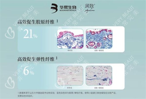 润致格格针咋样