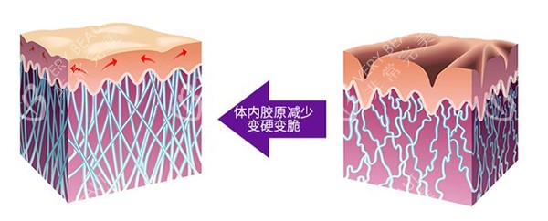 清秀针胶原蛋白示意图