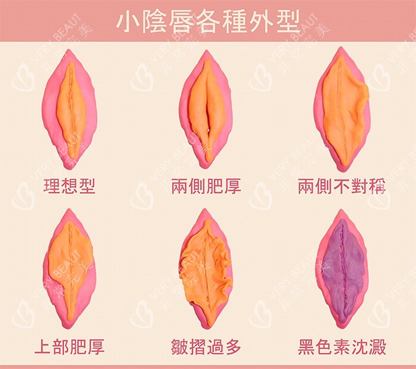 不同女性私密阴唇照片