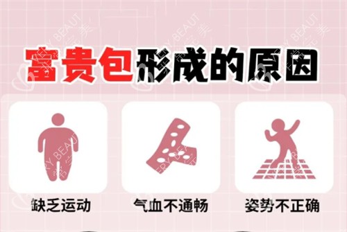 富贵包形成的原因