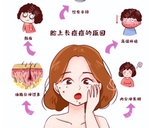 闭口问题的皮肤