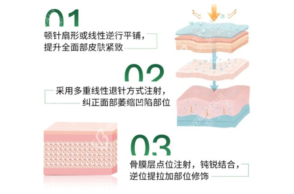 艾维岚注射皮肤层级图片