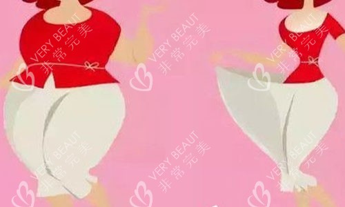 大腿吸脂前后对比图