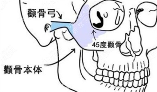 颧骨颧弓所在位置