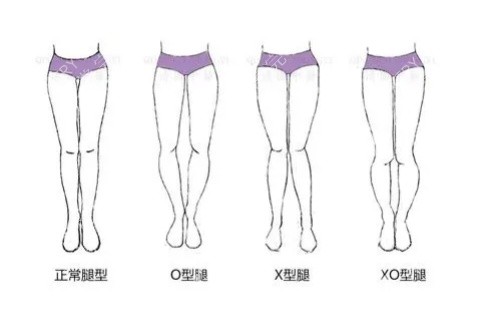 各种腿型卡通图