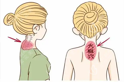 富贵包位置