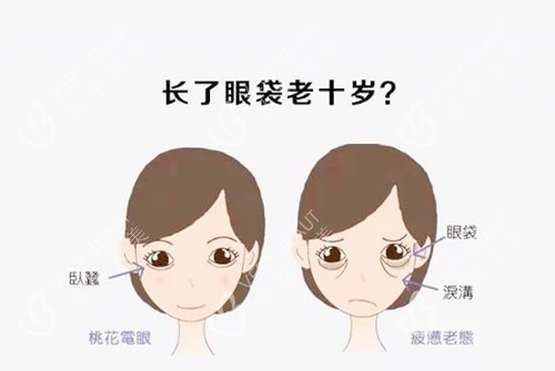 祛眼袋