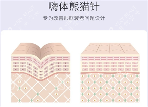 嗨体熊猫针皮肤组织动画展示