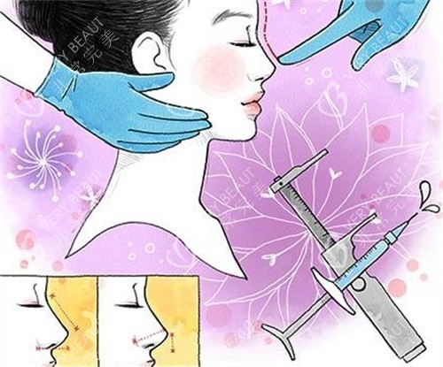面部鼻整形漫画示意图