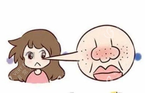 鼻子部位毛孔粗大示意图